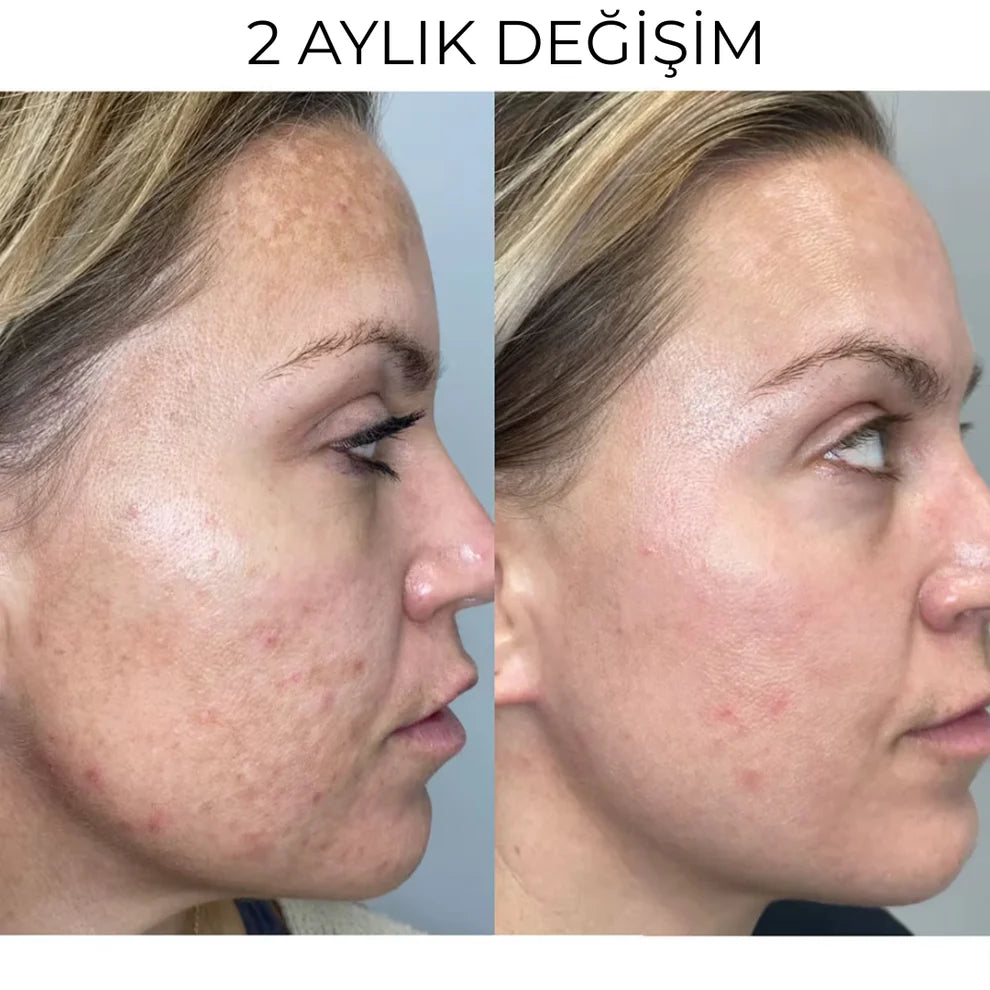 Menengiç & kenevir yağı kremi