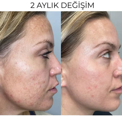 Menengiç & kenevir yağı kremi